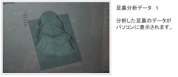 足裏分析