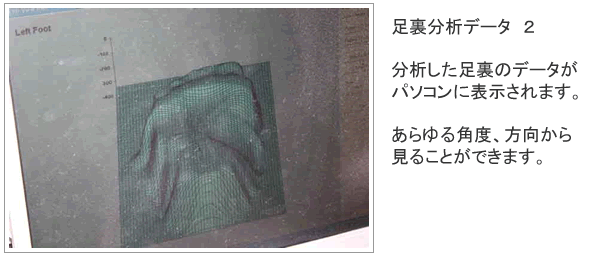 足裏分析